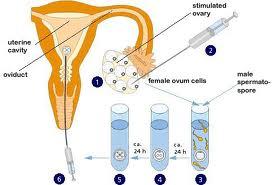 案例